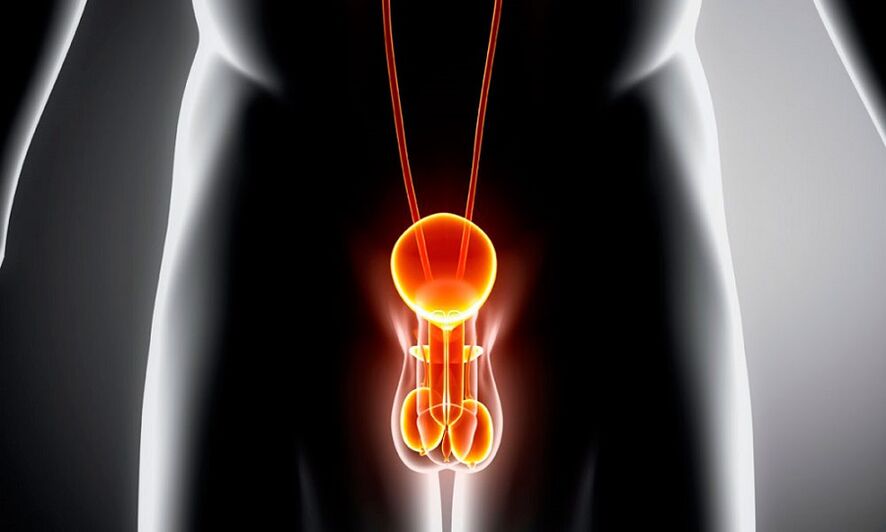 hệ thống sinh dục viêm cho viêm tuyến tiền liệt